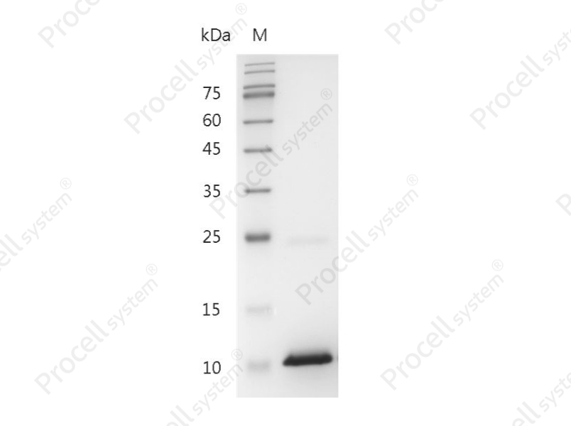 CXCL10/IP-10/Crg-2, Human, Recombinant
