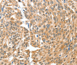 BAX Polyclonal Antibody - 2