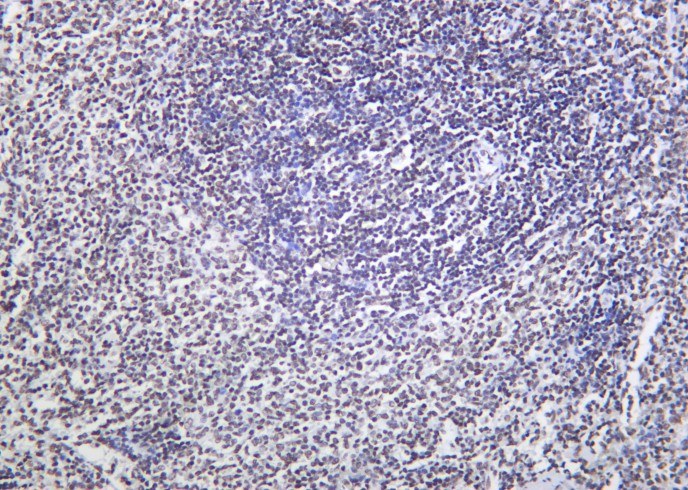 Recombinant Phospho-Rpb1 (Ser2) Monoclonal Antibody - 1