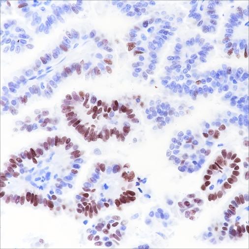 Recombinant SOX2 Monoclonal Antibody - 2