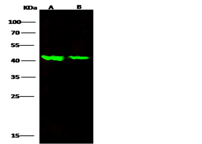 Recombinant ALK-1/ACVRL1 Monoclonal Antibody