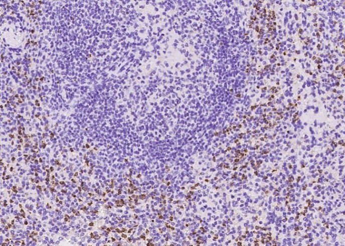 Recombinant CD4 Monoclonal Antibody - small - 3