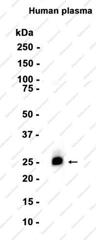 Recombinant Kappa light chain Monoclonal Antibody - 1