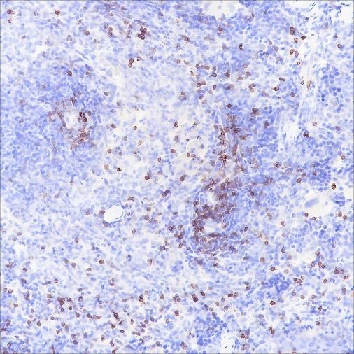 Recombinant CD3 epsilon Monoclonal Antibody - small - 6