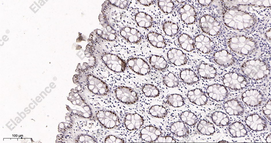 Recombinant KLF4 Monoclonal Antibody - 2