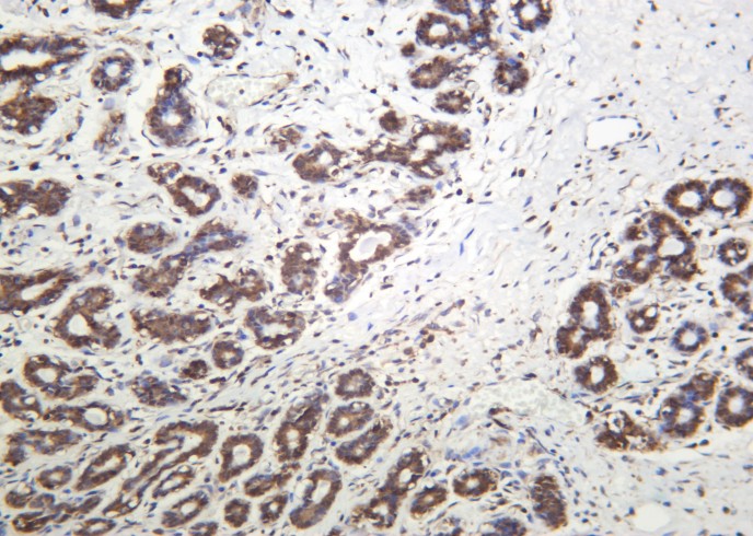 Recombinant Cofilin Monoclonal Antibody - small - 2