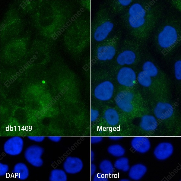 Recombinant IFITM1 Monoclonal Antibody - 4