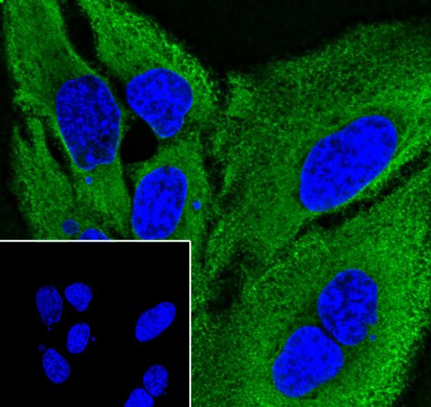 Recombinant IL-1RA Monoclonal Antibody - small - 4