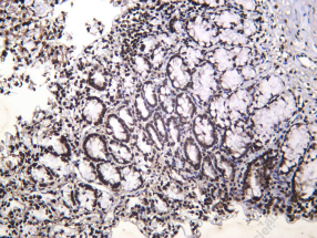 Recombinant MACROH2A1 Monoclonal Antibody - 4
