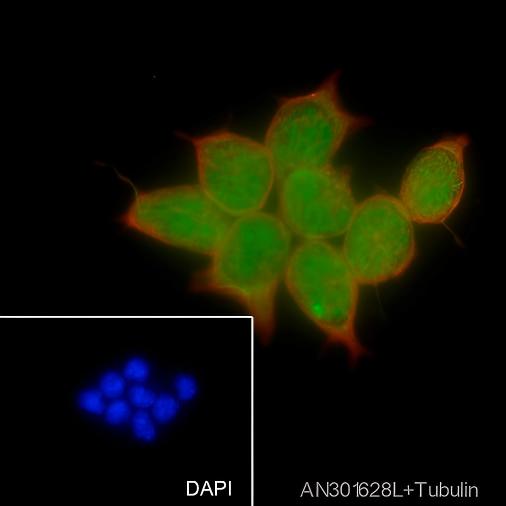 Recombinant PHF20 Monoclonal Antibody - 2