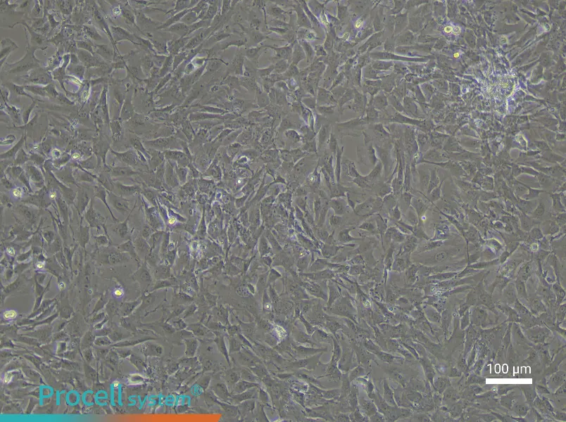Rat Pulmonary Vascular Smooth Muscle Cell Complete Medium - 1