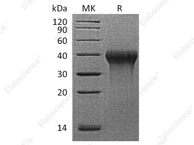 Recombinant Rhesus macaque CD27/TNFRSF7 Protein (His Tag) - 1