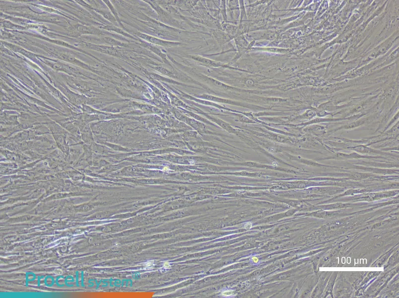 Human Glomerular Mesangial Cell Complete Medium - 1
