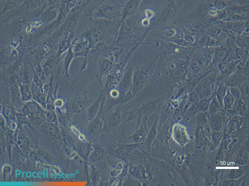 Human Synovial Fibroblast (Primary cell immortalization) Complete MediumHuman Synovial Fibroblast (Primary cell immortalization) Complete Medium - 4
