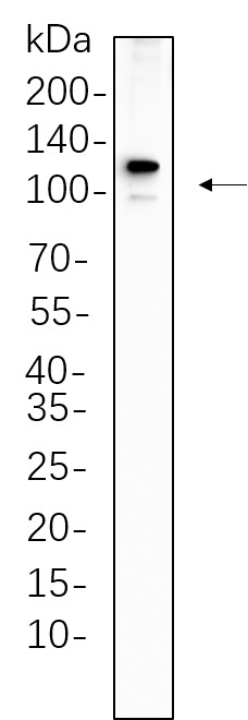 Recombinant PMS2 Monoclonal Antibody-searchlist-1