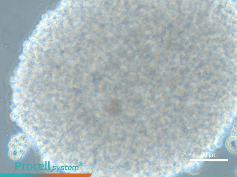HH [Human lymphoma] - 6