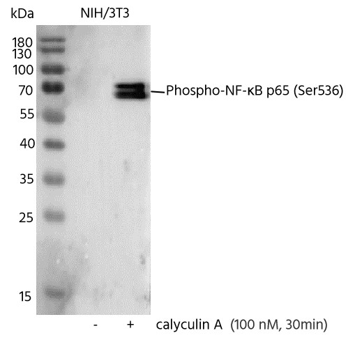Recombinant Phospho-NF-κB p65 (Ser536) Monoclonal Antibody - small - 4