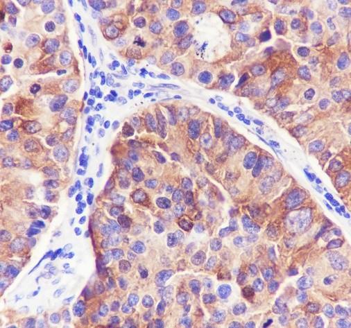 Recombinant beta III Tubulin Monoclonal Antibody - small - 3