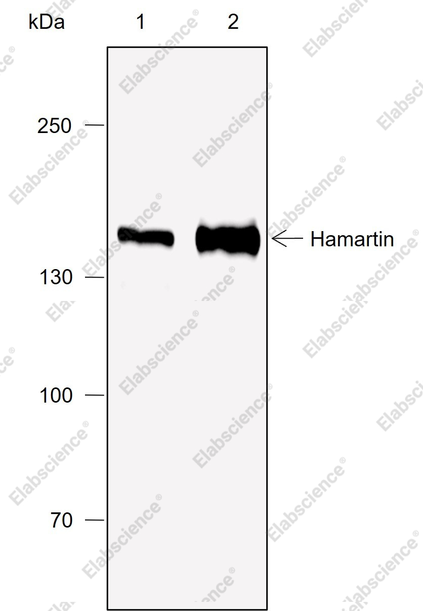 Recombinant Hamartin Monoclonal Antibody - 1