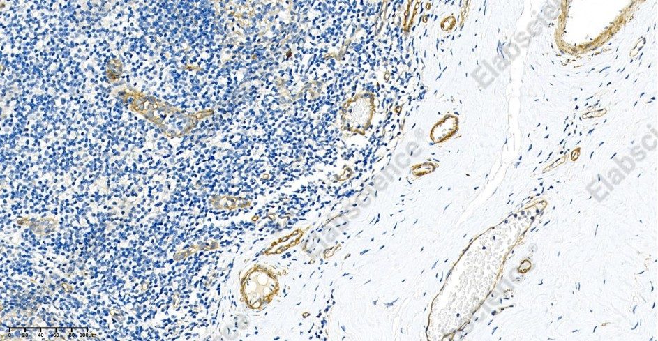 Recombinant CD146 Monoclonal Antibody - 2