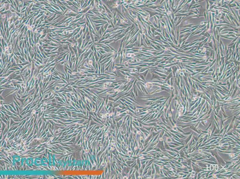 MEL270 Cell Complete Medium - 1