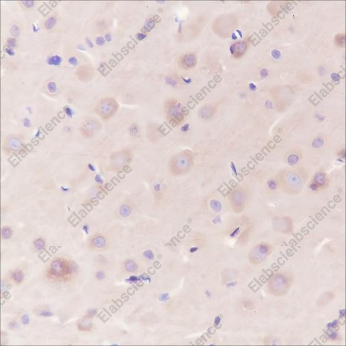 Recombinant Dynamin 1 Monoclonal Antibody - 4