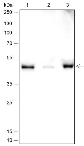 Recombinant PDK2 Monoclonal Antibody - 2