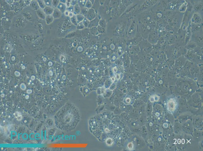 HARA-B Cell Complete Medium - small - 5