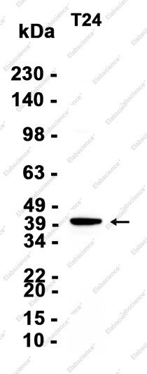 Recombinant G protein alpha 13 Monoclonal Antibody - 2