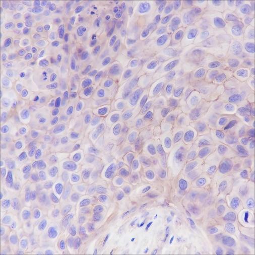 Recombinant B7-H3/CD276 Monoclonal Antibody - 3