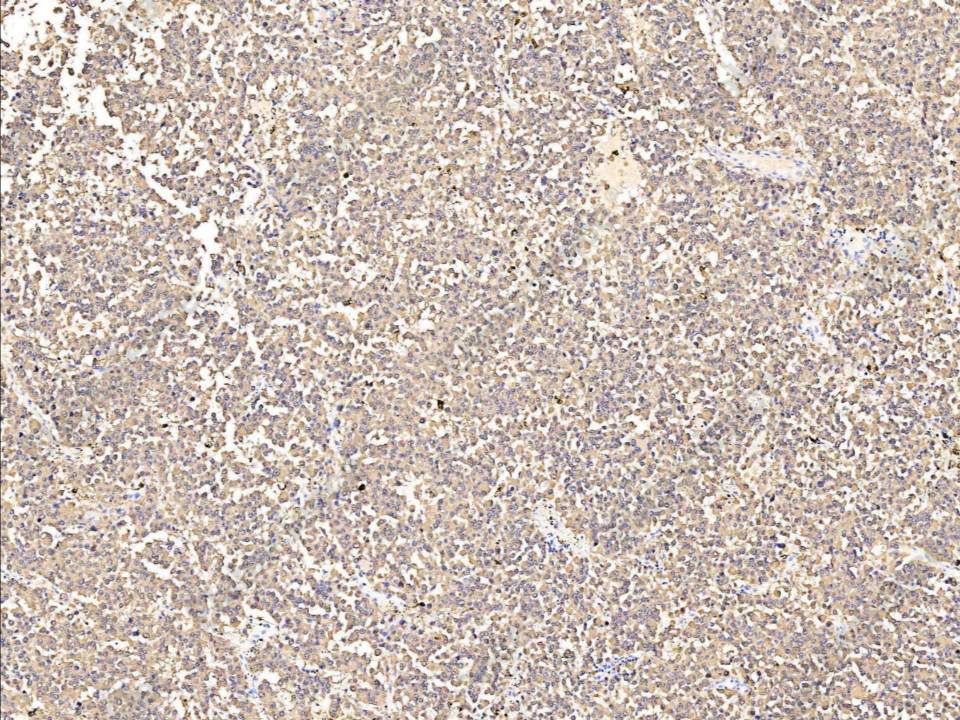 Recombinant S100B Monoclonal Antibody - 1