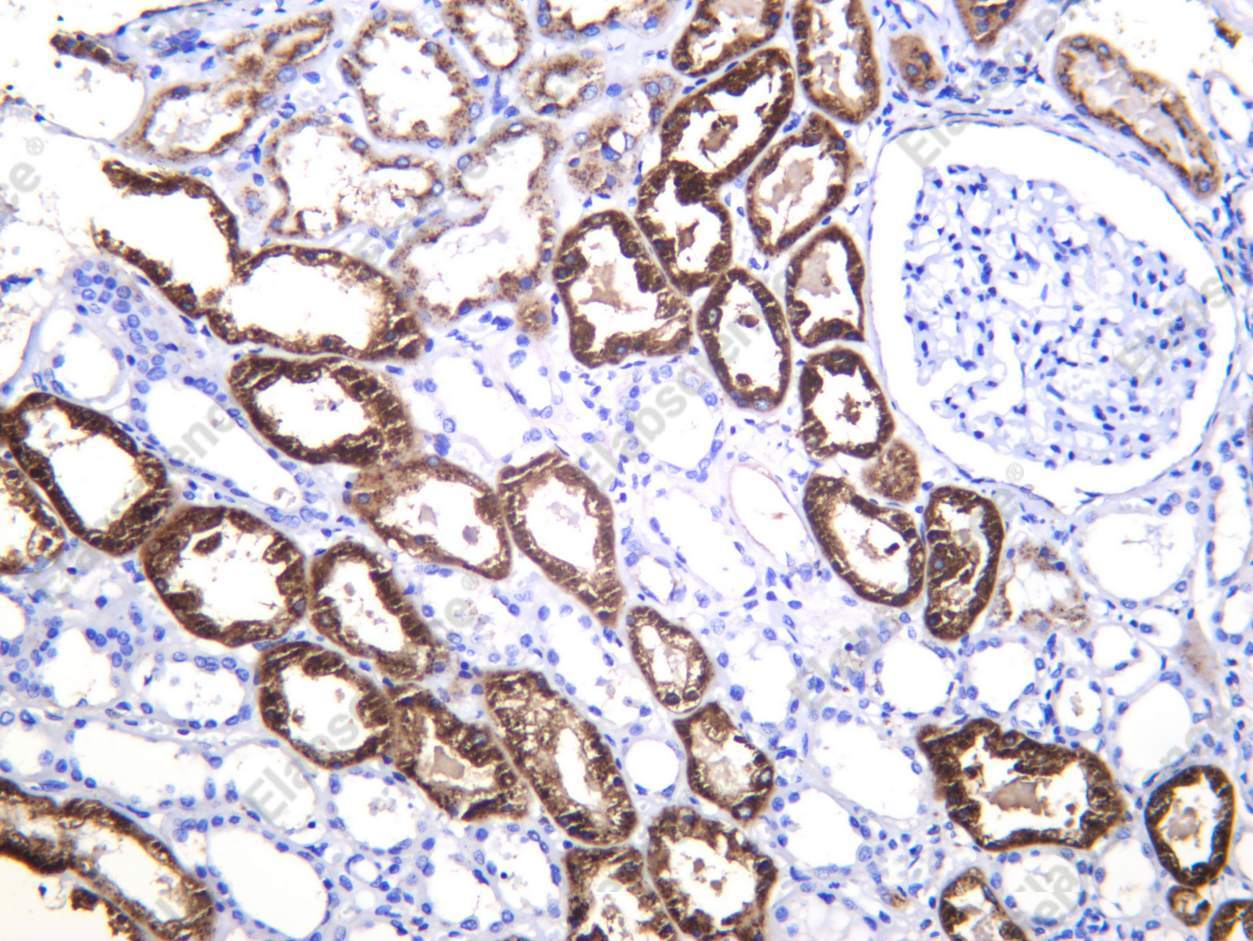 Recombinant Napsin A Monoclonal Antibody - 1
