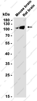 Recombinant Ubiquitin Protein Ligase E3A Monoclonal Antibody - 2