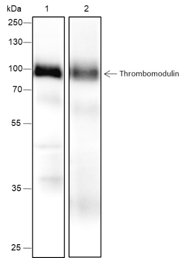 Recombinant Thrombomodulin Monoclonal Antibody-searchlist-1