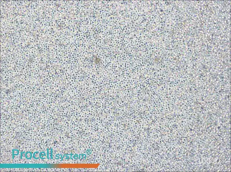 NOMO-1 Cell Complete MediumNOMO-1 Cell Complete Medium - 2