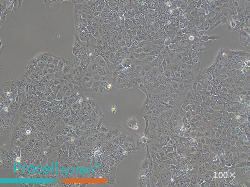 JEG-3 Cell Complete Medium - 1