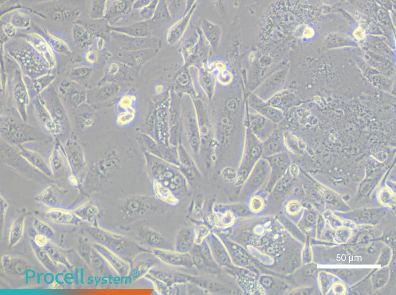 OV56 Cell Complete MediumOV56 Cell Complete Medium - 5