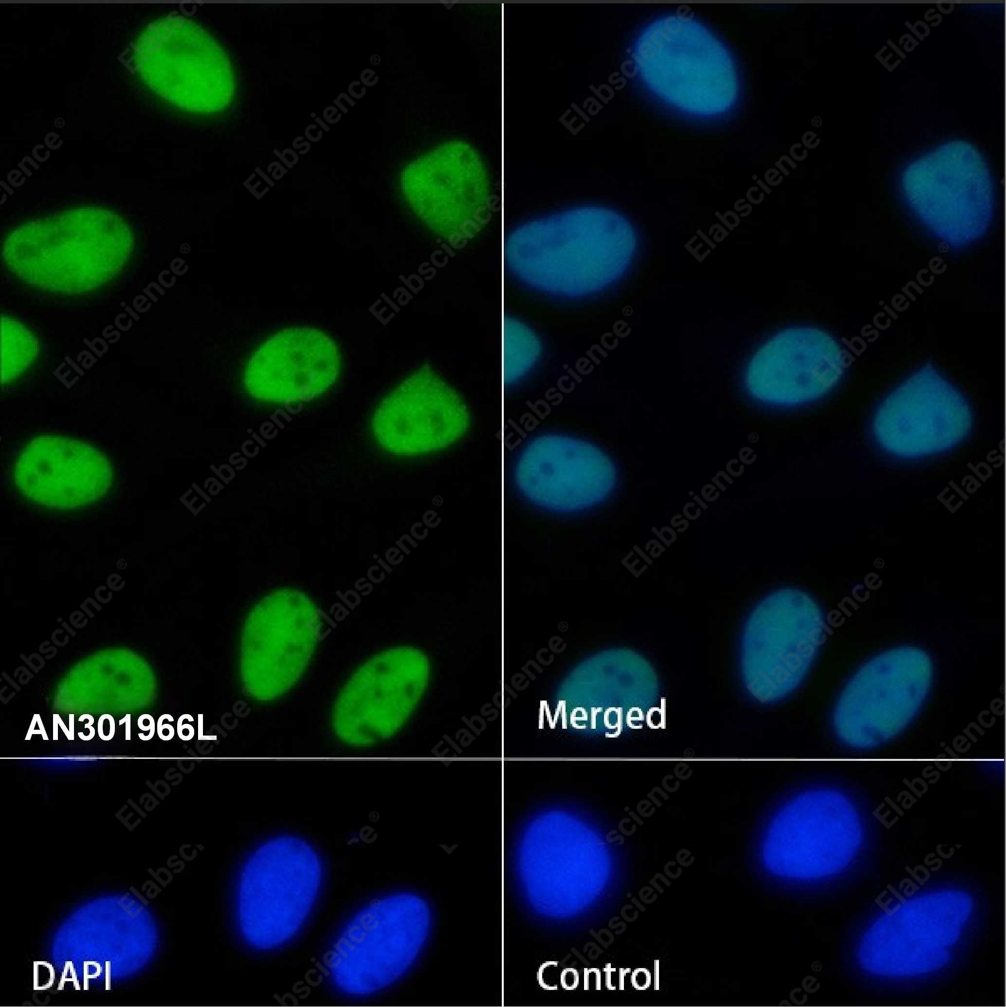 Recombinant SP1 Monoclonal Antibody - 3
