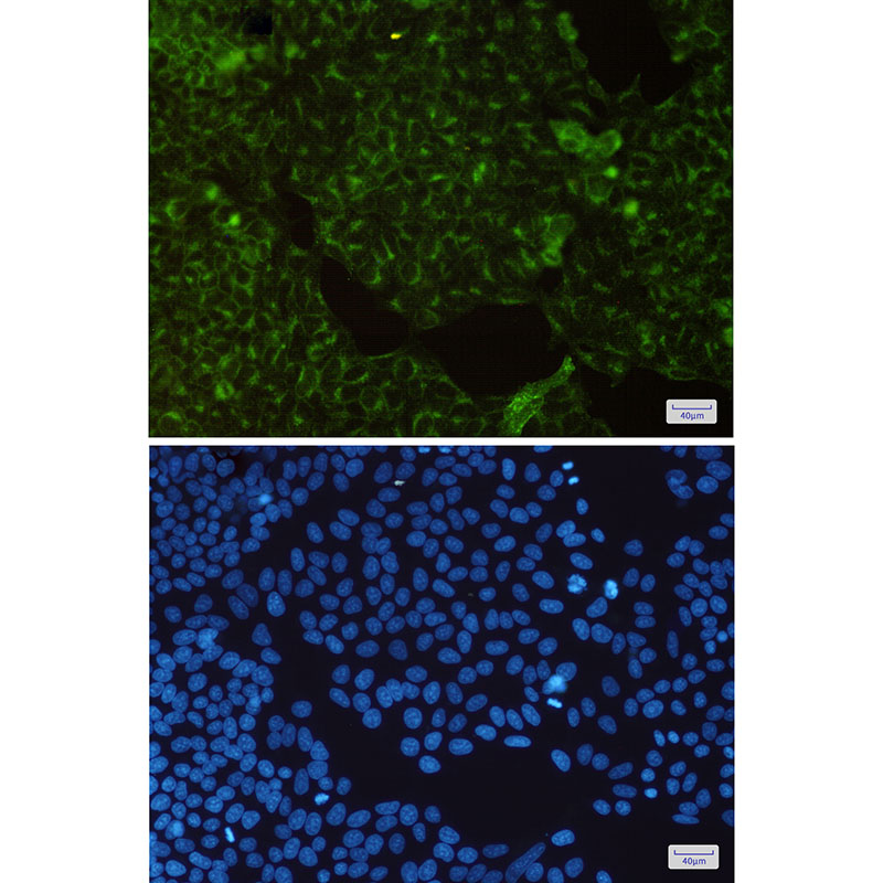 Recombinant Transferrin Receptor/TFRC/CD71 Monoclonal Antibody - 2