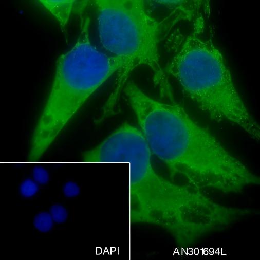 Recombinant Keratin 13 Monoclonal Antibody - 3
