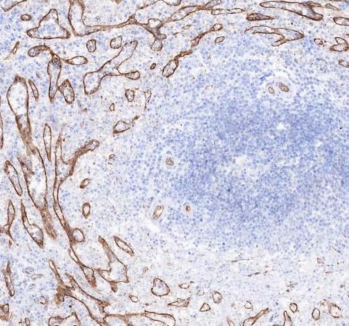 Recombinant ICAM-2 Monoclonal Antibody-searchlist-3