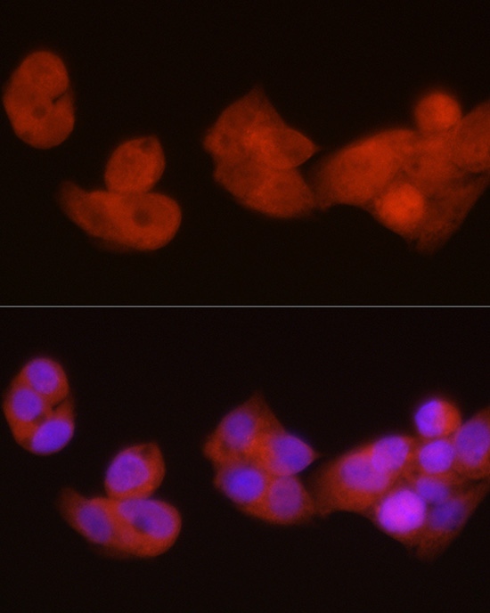 PGC1 alpha Polyclonal Antibody - small - 4