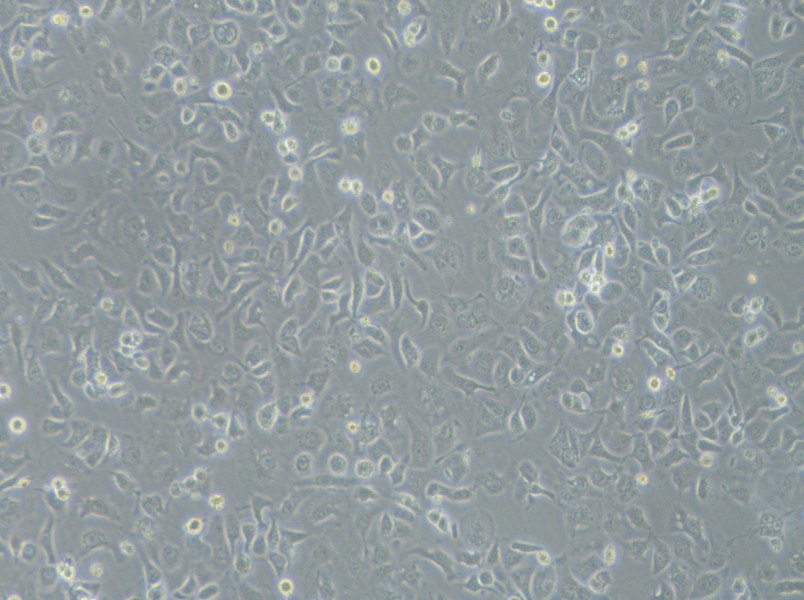 IGROV-1 Cell Complete MediumIGROV-1 Cell Complete Medium - 2