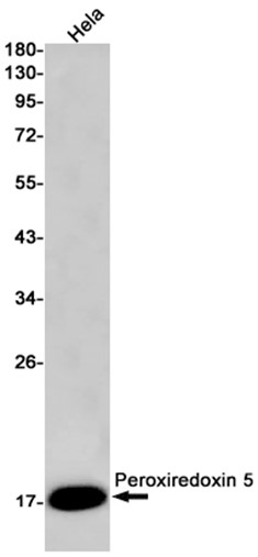 Recombinant Peroxiredoxin 5/PRDX5 Monoclonal Antibody - 1