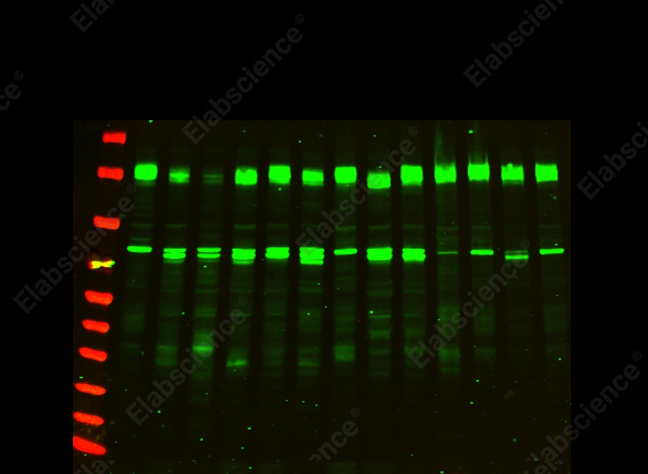 Recombinant PERK Monoclonal Antibody - 1