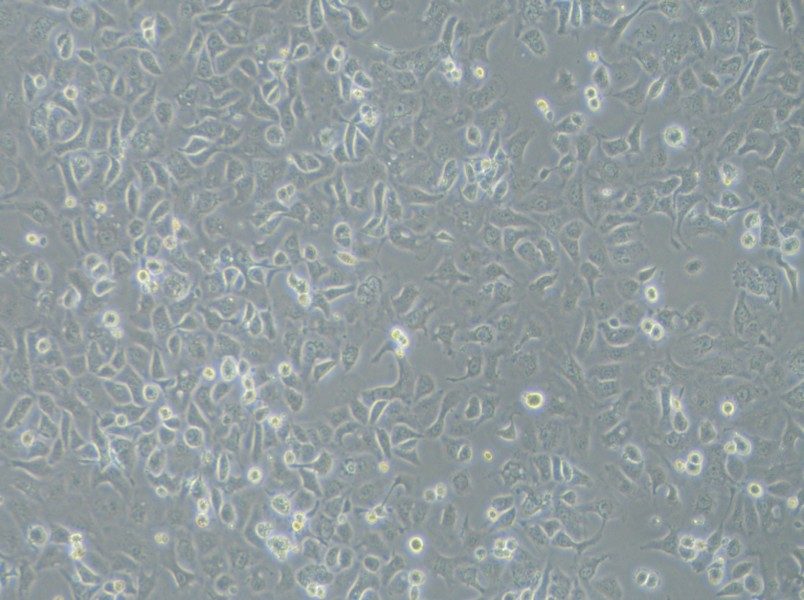 IGROV-1 Cell Complete Medium-searchlist-1