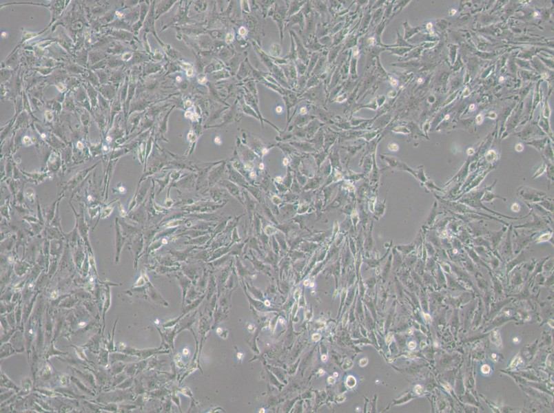IBRS-2 [IB-RS-2] Cell Complete MediumIBRS-2 [IB-RS-2] Cell Complete Medium - 2