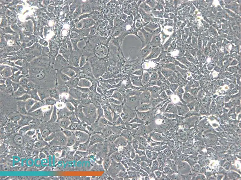 KYSE-140 Cell Complete Medium - 6