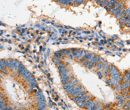 FAS Polyclonal Antibody - 2