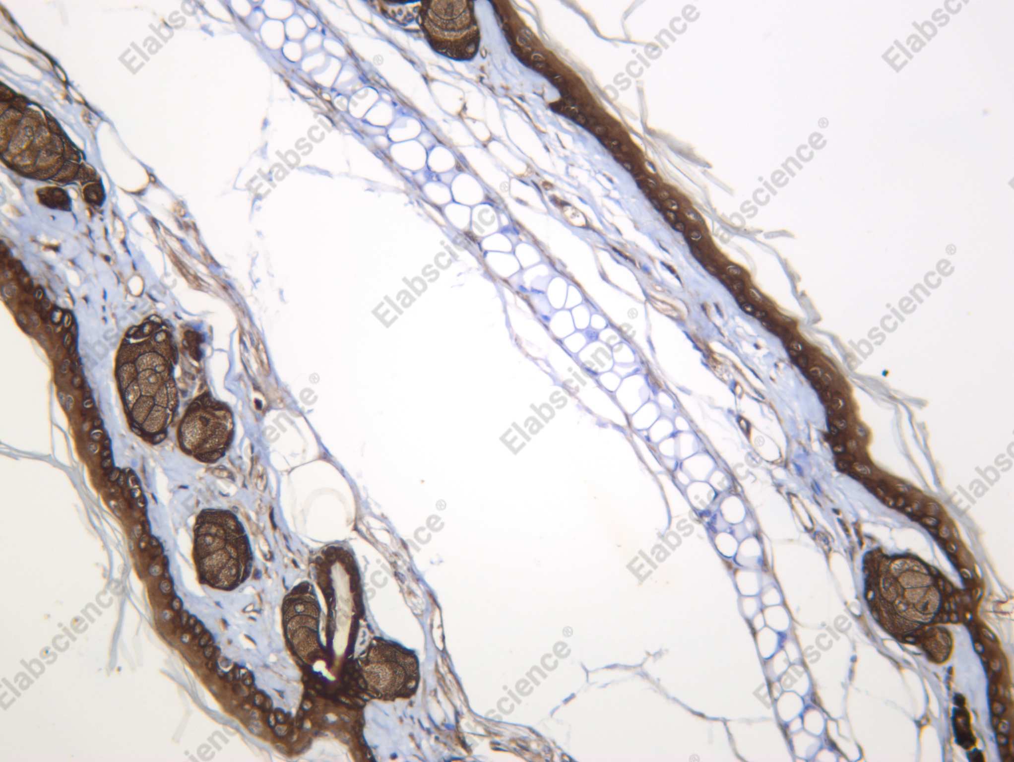 Recombinant Keratin 4 Monoclonal Antibody - 3